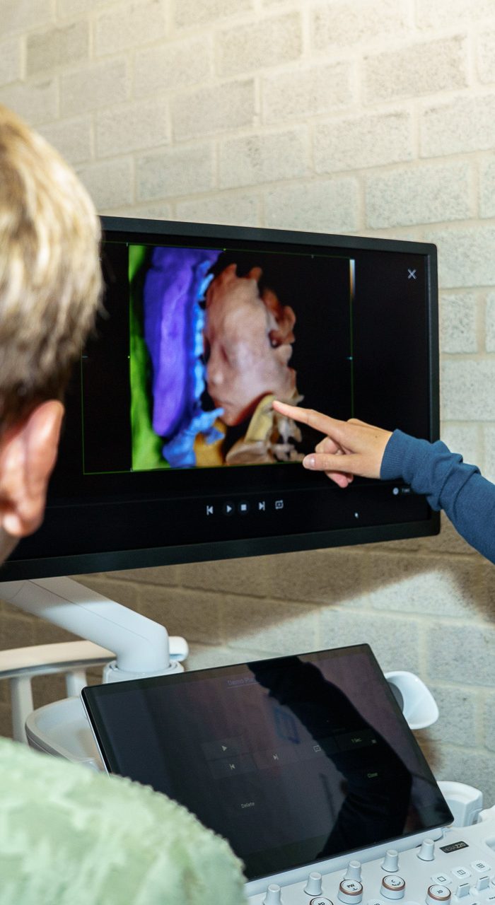Applicatiespecialist Echografie bij Benetec